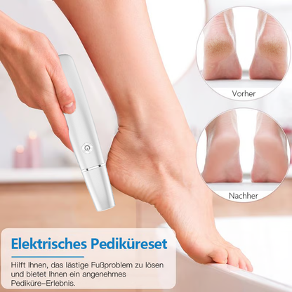 💥Elektrischer Hornhautentferner für die Füße👣