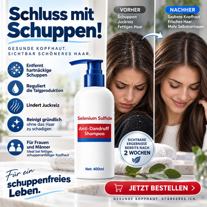 Selensulfid Anti-Schuppen- und Ölregulierendes Shampoo